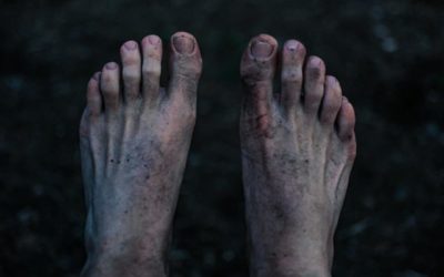 Polyneuropathien, Teil II: die direkten Links zum Hintergrundwissen