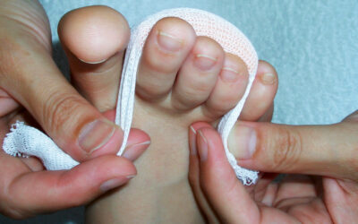BUCHTIPP: Nagel- und Hautprobleme besser erkennen und behandeln