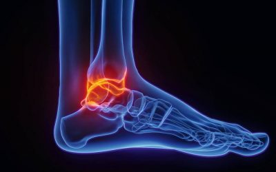 Fußbeschwerden: Dem Schmerz auf der Spur – Teil I
