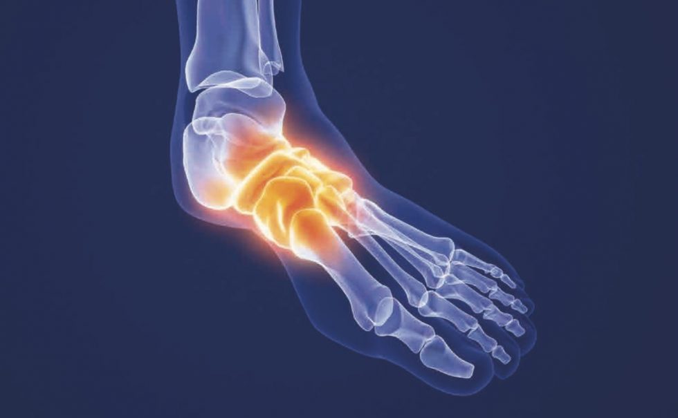Der CharcotFuß Früherkennung ist wichtig Podologie