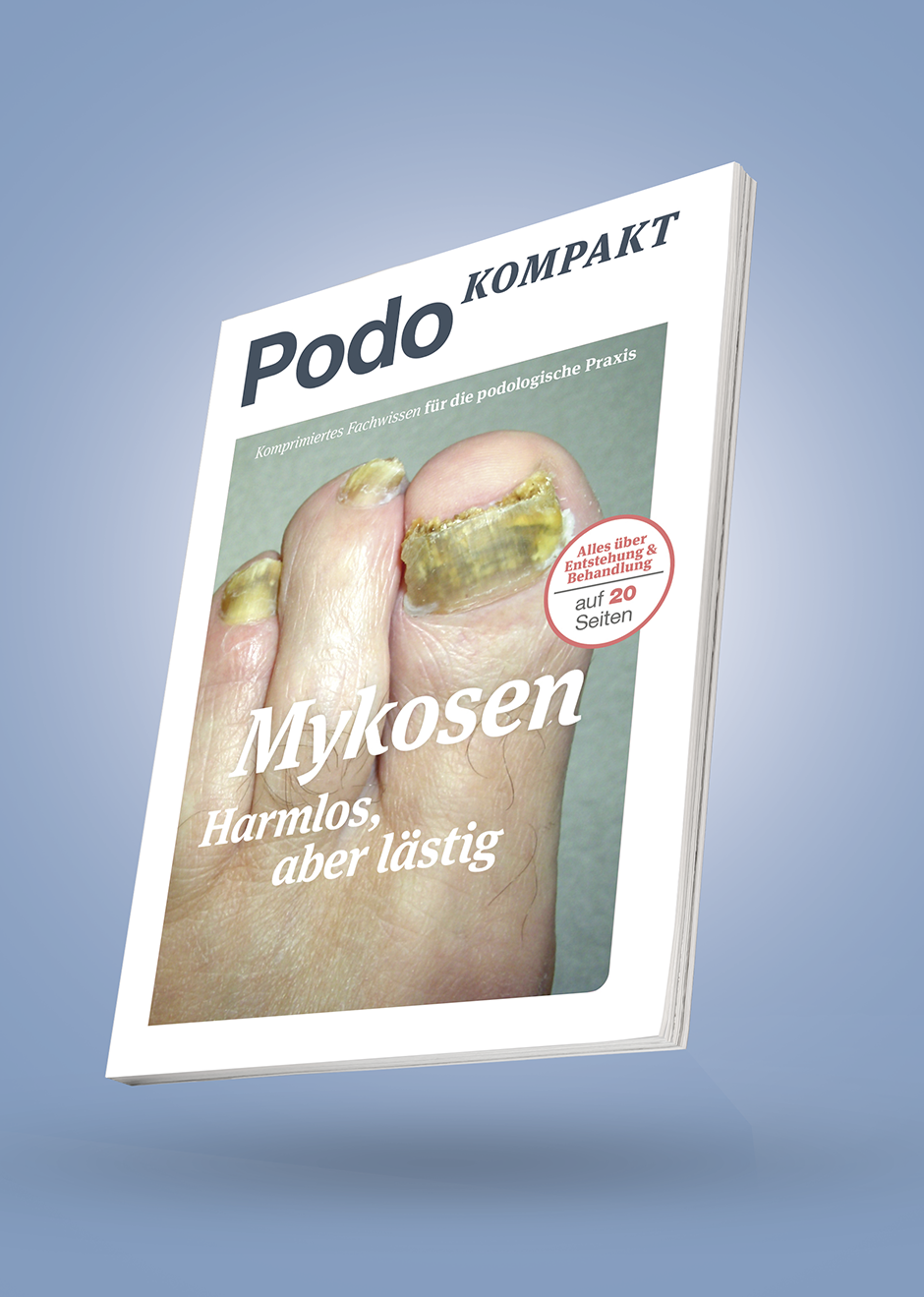 3D Buch_01_Mykosen_02_150dpi gratis-whitepaper-mykosen