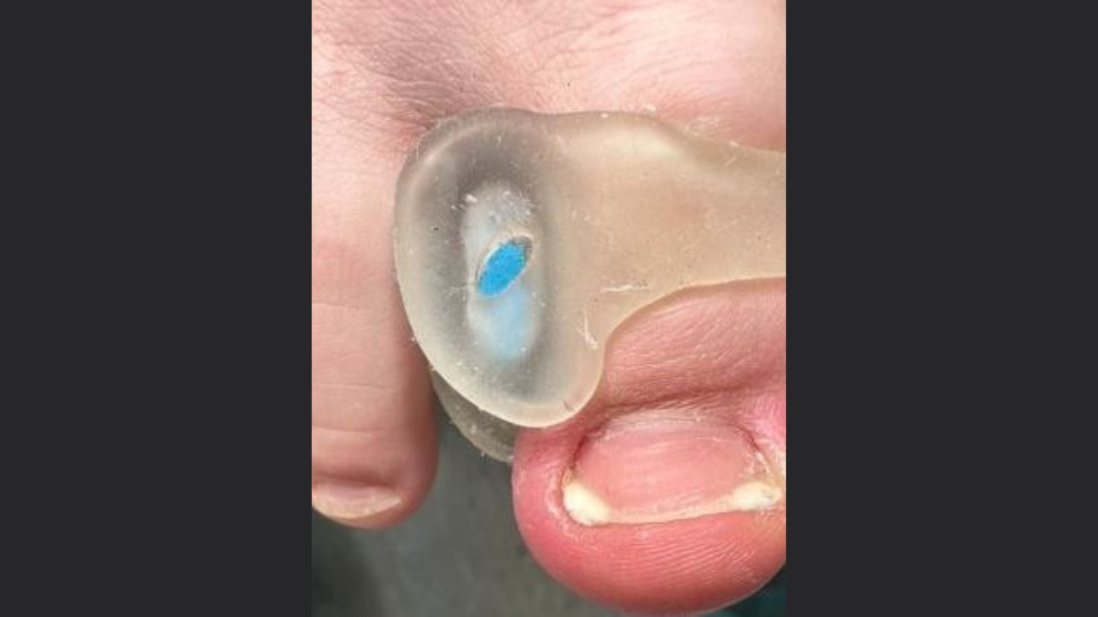 Mitmach-Strategie-online Behandlung von Kindern in der podologischen Praxis